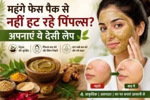 महंगे फेस पैक से भी पिंपल्स नहीं हट रहे? नीम, हल्दी और अन्य प्राकृतिक सामग्री से बने देसी लेप का उपयोग करती महिला।